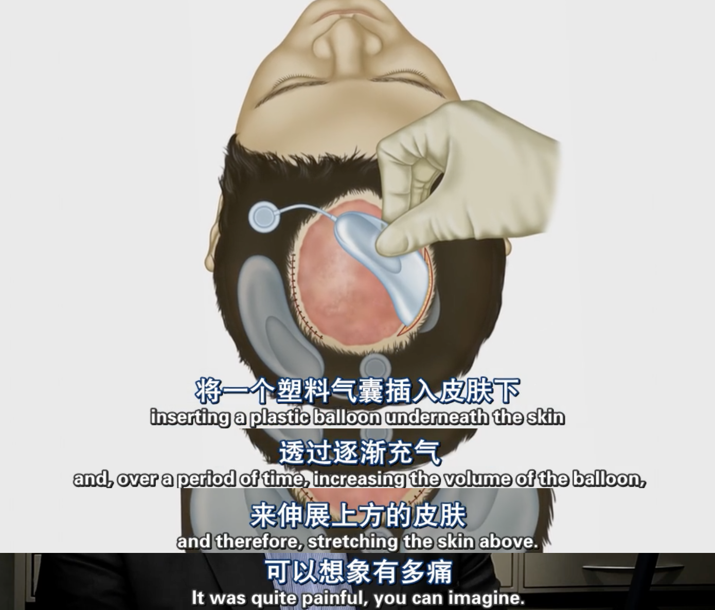 19.png
