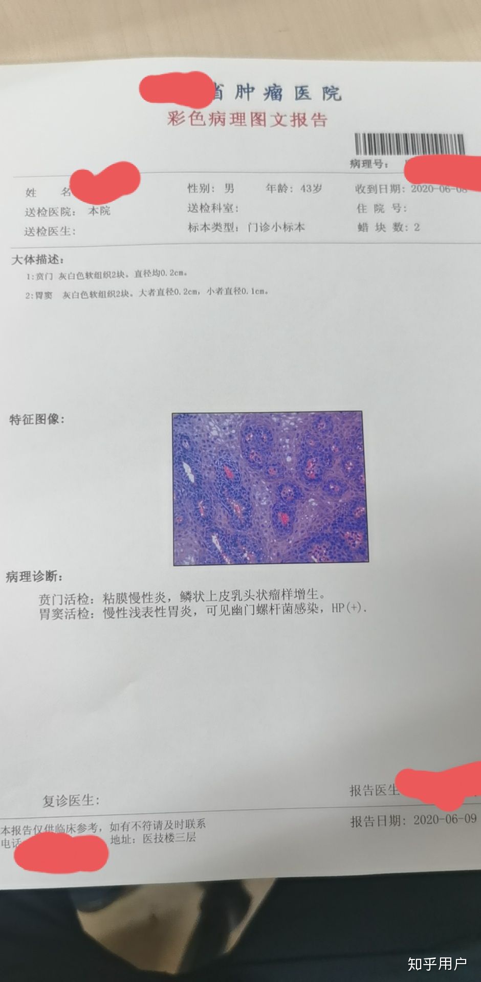 E79CA759-07D5-4CE3-AC2A-F93ED74CFECC.jpeg