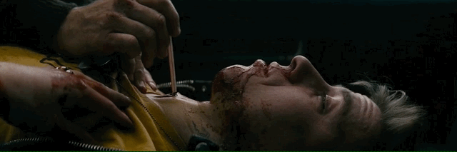 17.gif