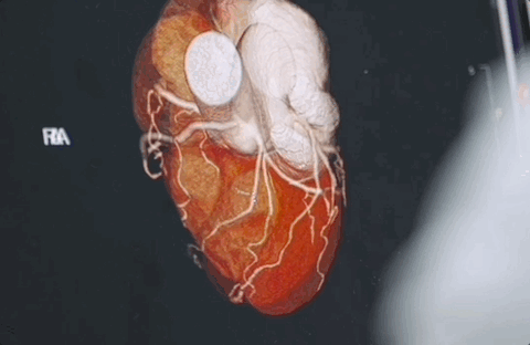 IMG_3232.GIF